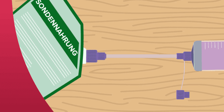 Bolus Adapter: Aufziehhilfe für die Bolusgabe